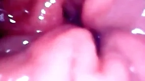 Medial my anal pussy news