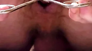 Prosaic hose enema coupled with anal flourishing